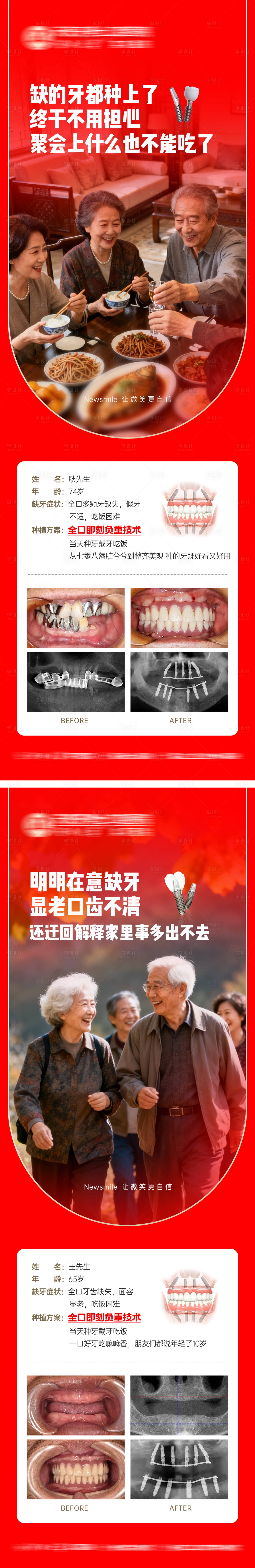 源文件下载【享设计】搜索编号：73020033478559396【种植牙氛围感照片场景海报】