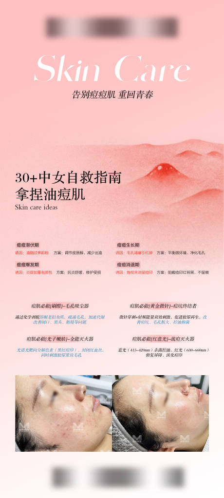源文件下载【享设计】搜索编号：39450033609129892【30+中女自救油痘肌宣传海报】