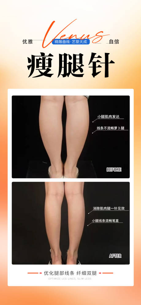 源文件下载【享设计】搜索编号：97380033622722588【瘦腿针】