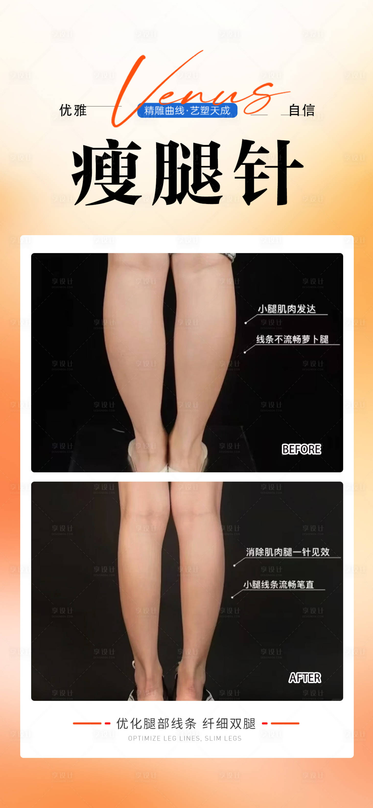 源文件下载【享设计】搜索编号：97380033622722588【瘦腿针】