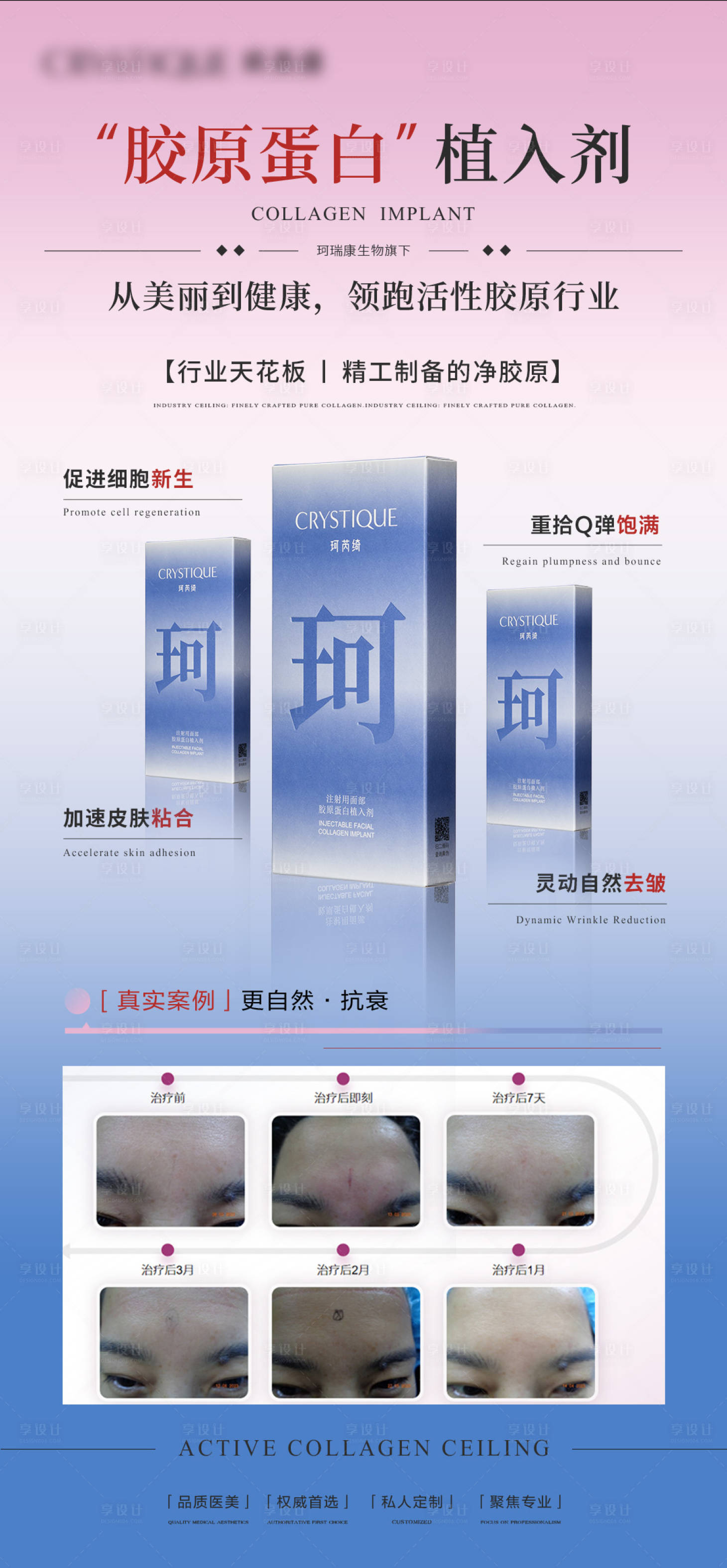 源文件下载【享设计】搜索编号：18370033562984144【医美胶原蛋白植入剂海报】