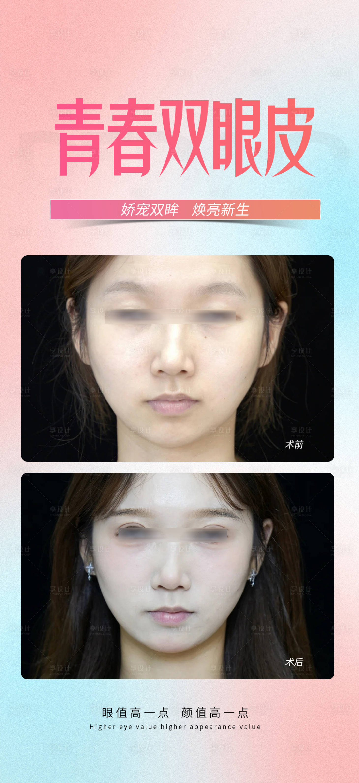 源文件下载【享设计】搜索编号：73840033366238396【青春双眼皮】