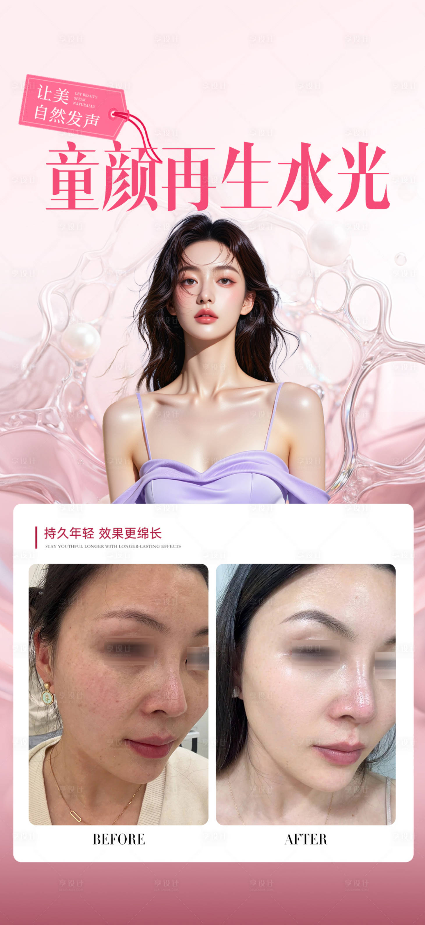 源文件下载【享设计】搜索编号：15910033779844018【水光案例对比海报】