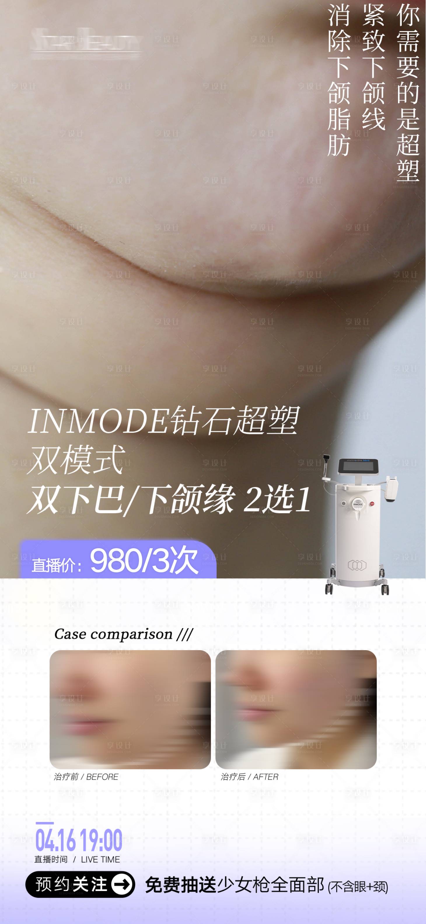 源文件下载【享设计】搜索编号：65870033372711359【InMode钻石超塑双下巴 】