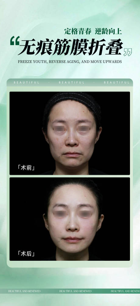 源文件下载【享设计】搜索编号：20160033553044334【无痕筋膜提升海报】