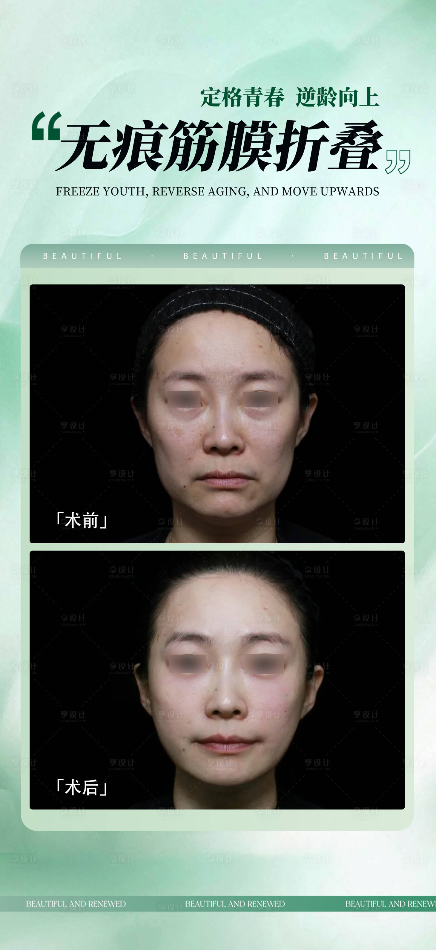 源文件下载【享设计】搜索编号：20160033553044334【无痕筋膜提升海报】