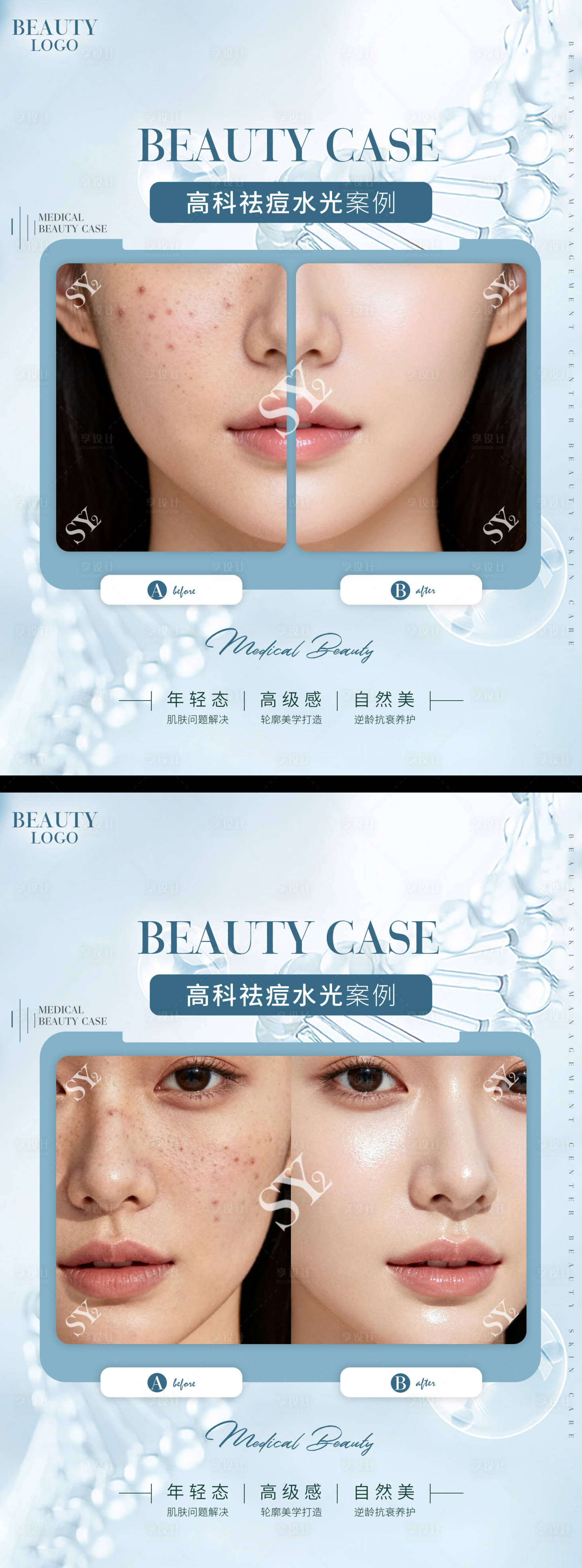 源文件下载【享设计】搜索编号：37890033361429589【医美对比图 】