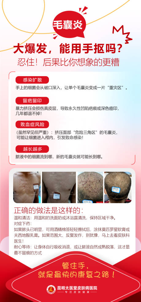 源文件下载【享设计】搜索编号：54600033687847712【毛囊炎科普海报】