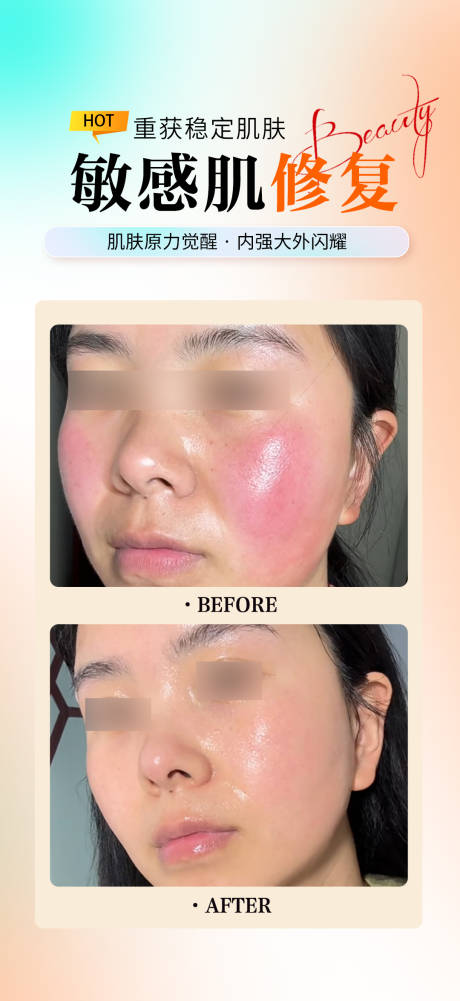 源文件下载【享设计】搜索编号：52140033780263542【敏感肌修复海报】