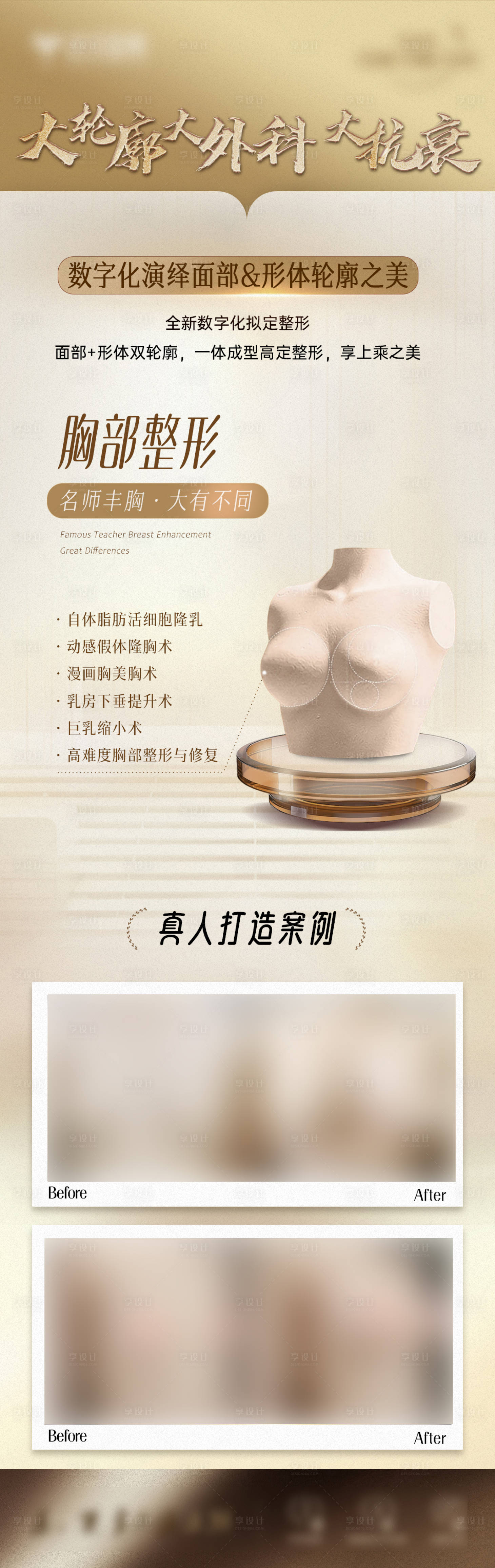 源文件下载【享设计】搜索编号：64620027139385324【胸部整形丰胸案例对比长图】