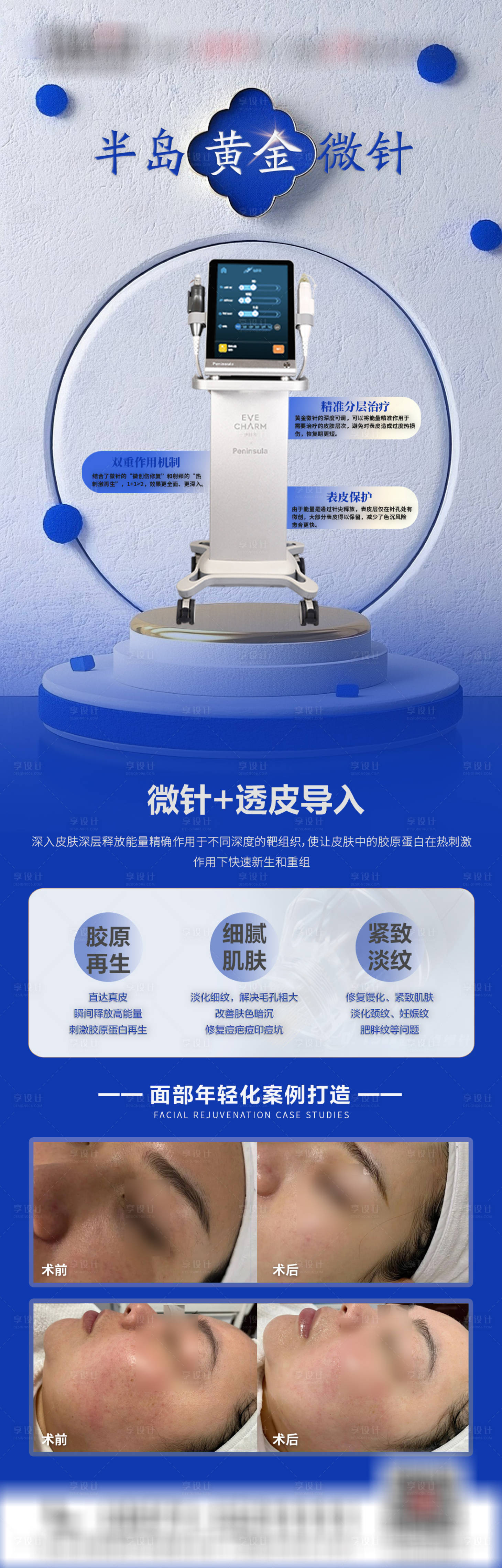 源文件下载【享设计】搜索编号：81970033675653296【黄金微针海报】