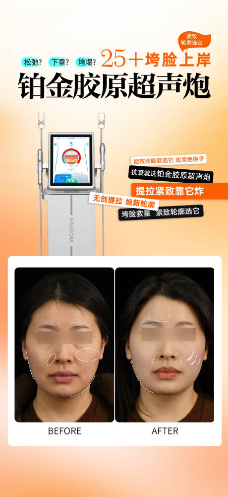 源文件下载【享设计】搜索编号：54380033800749673【胶原超声炮案例宣传海报】