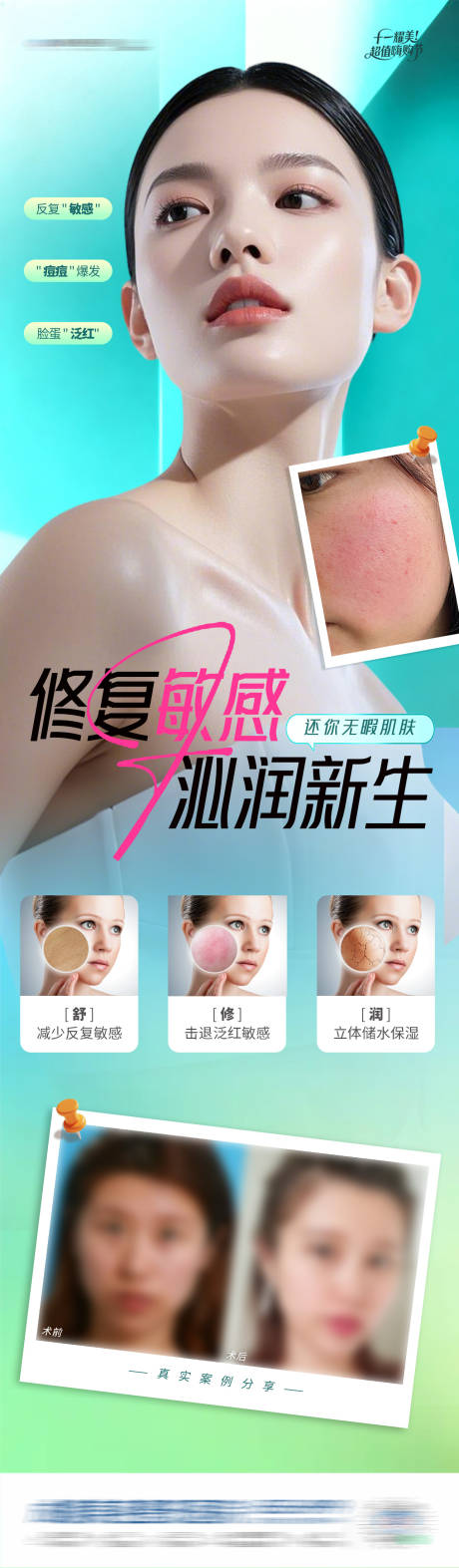 源文件下载【享设计】搜索编号：11940033691815077【医美敏感修复案例对比创意长图海报】