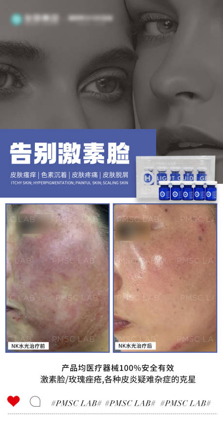 源文件下载【享设计】搜索编号：13070033532913926【告别激素脸海报】