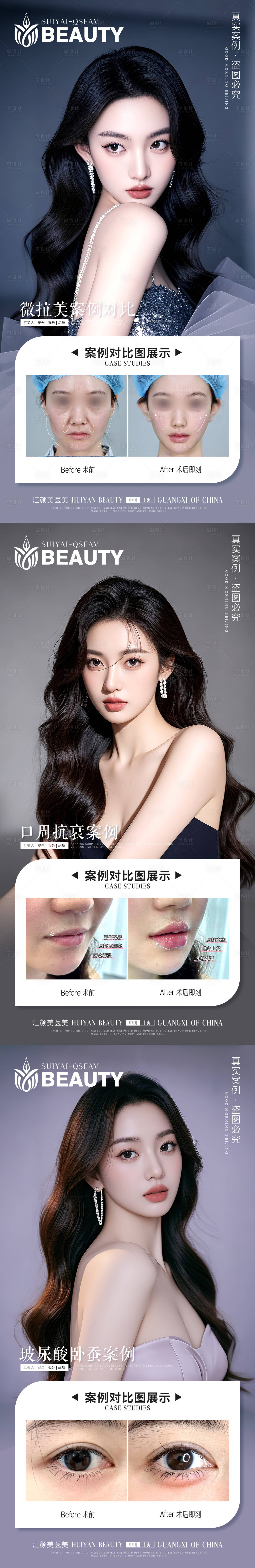 源文件下载【享设计】搜索编号：22250033477277577【医美案例】