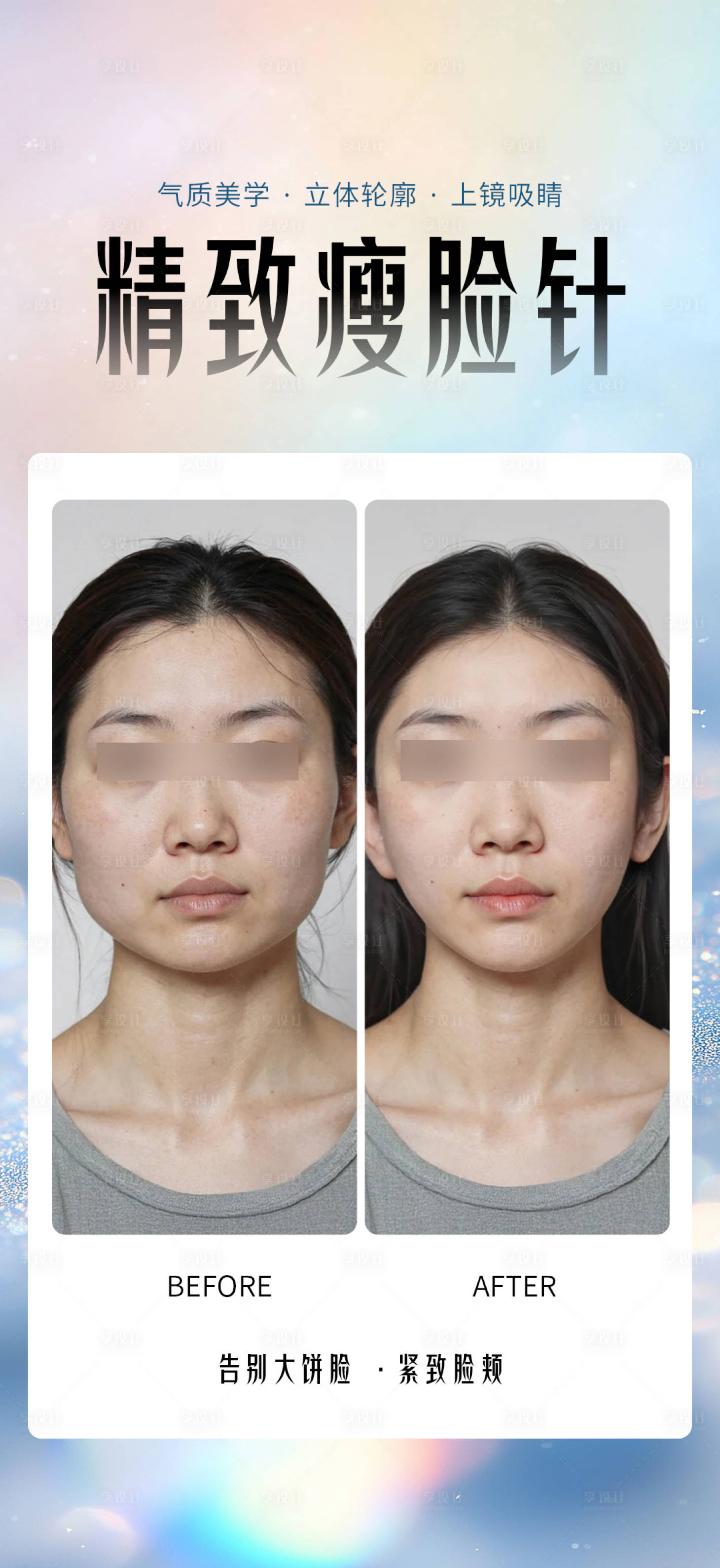 源文件下载【享设计】搜索编号：60430033799782569【瘦脸针案例】