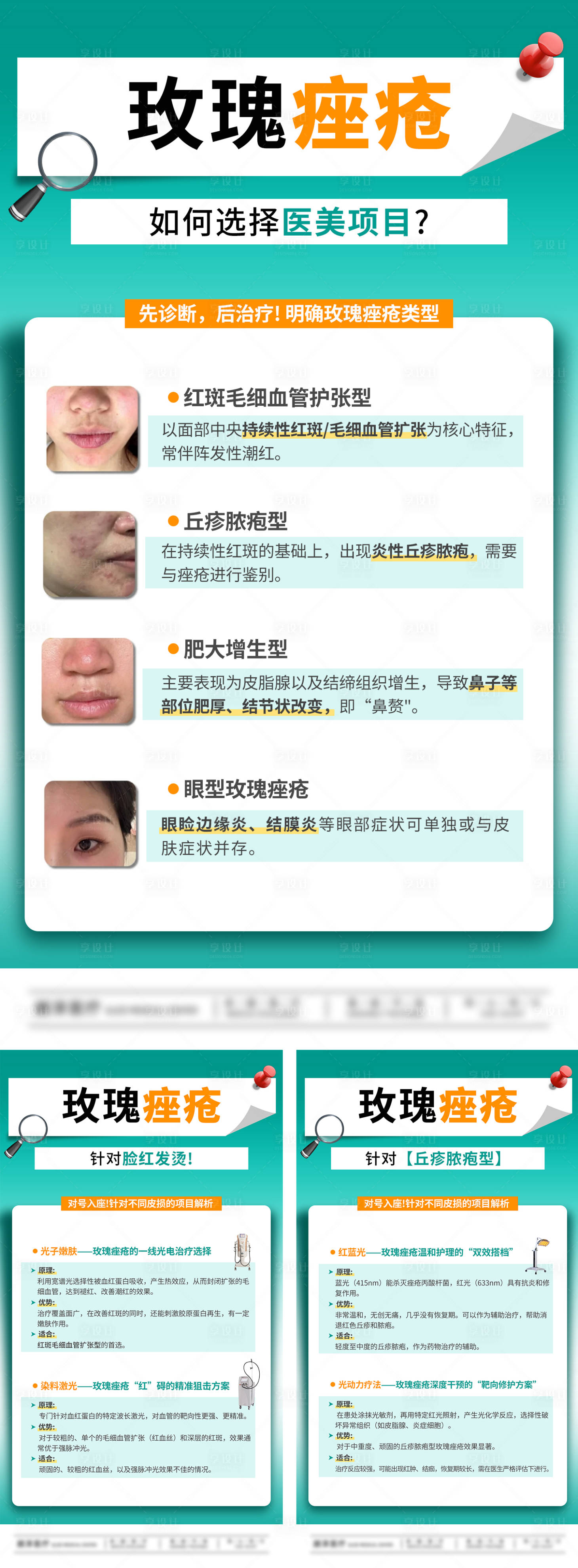 源文件下载【享设计】搜索编号：53800033634823722【玫瑰痤疮皮肤科普】