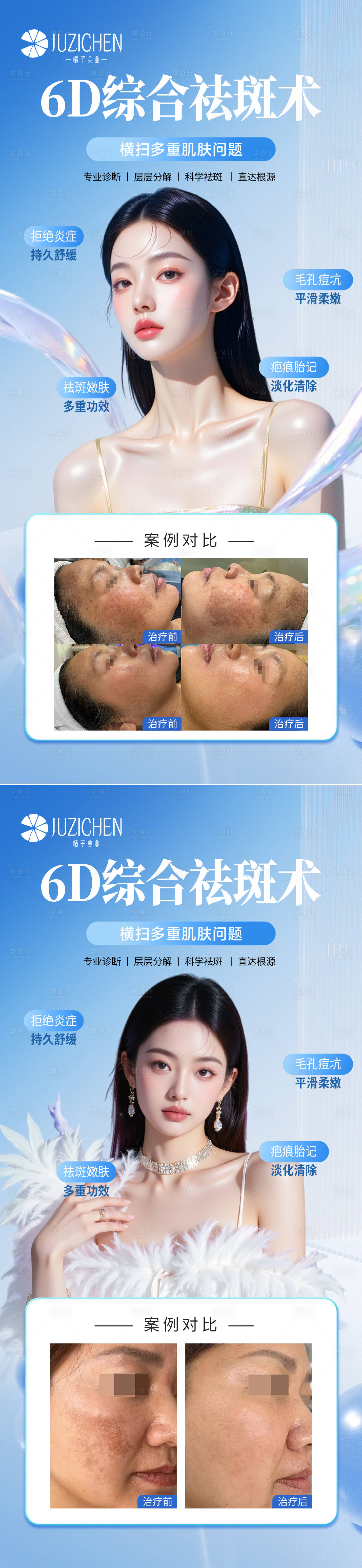 源文件下载【享设计】搜索编号：75570033447148717【医美祛斑系列海报】