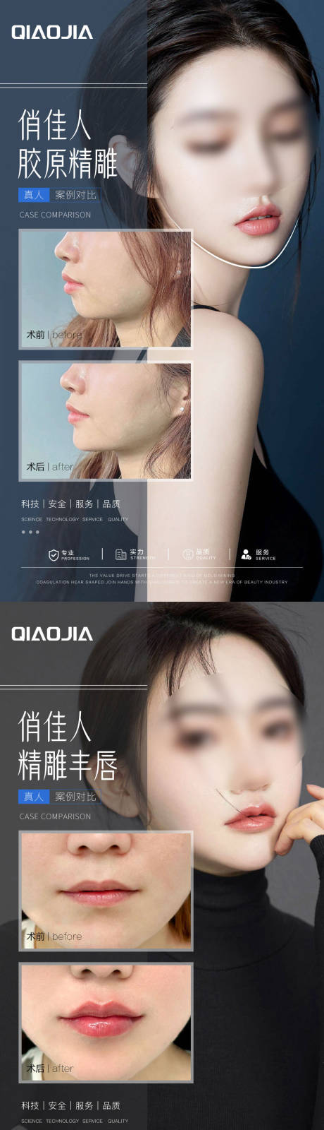 源文件下载【享设计】搜索编号：40600033437211036【精雕M唇下巴】