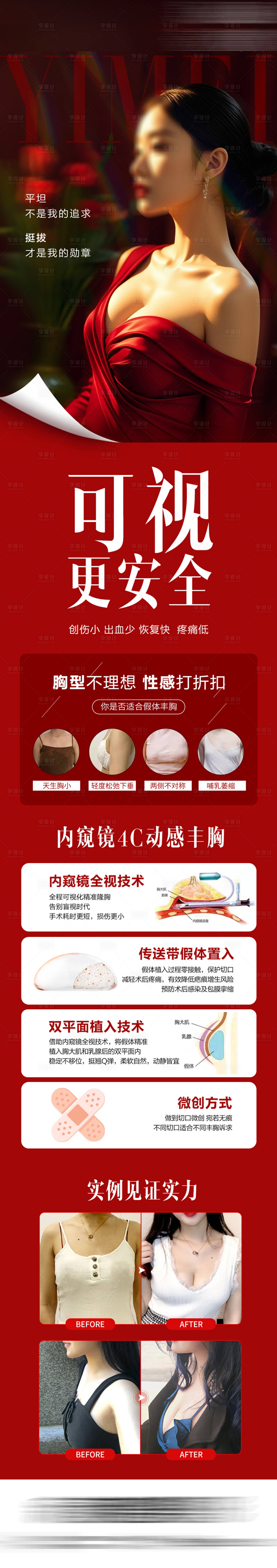 源文件下载【享设计】搜索编号：13620034178102862【医美4C动感丰胸海报长图】