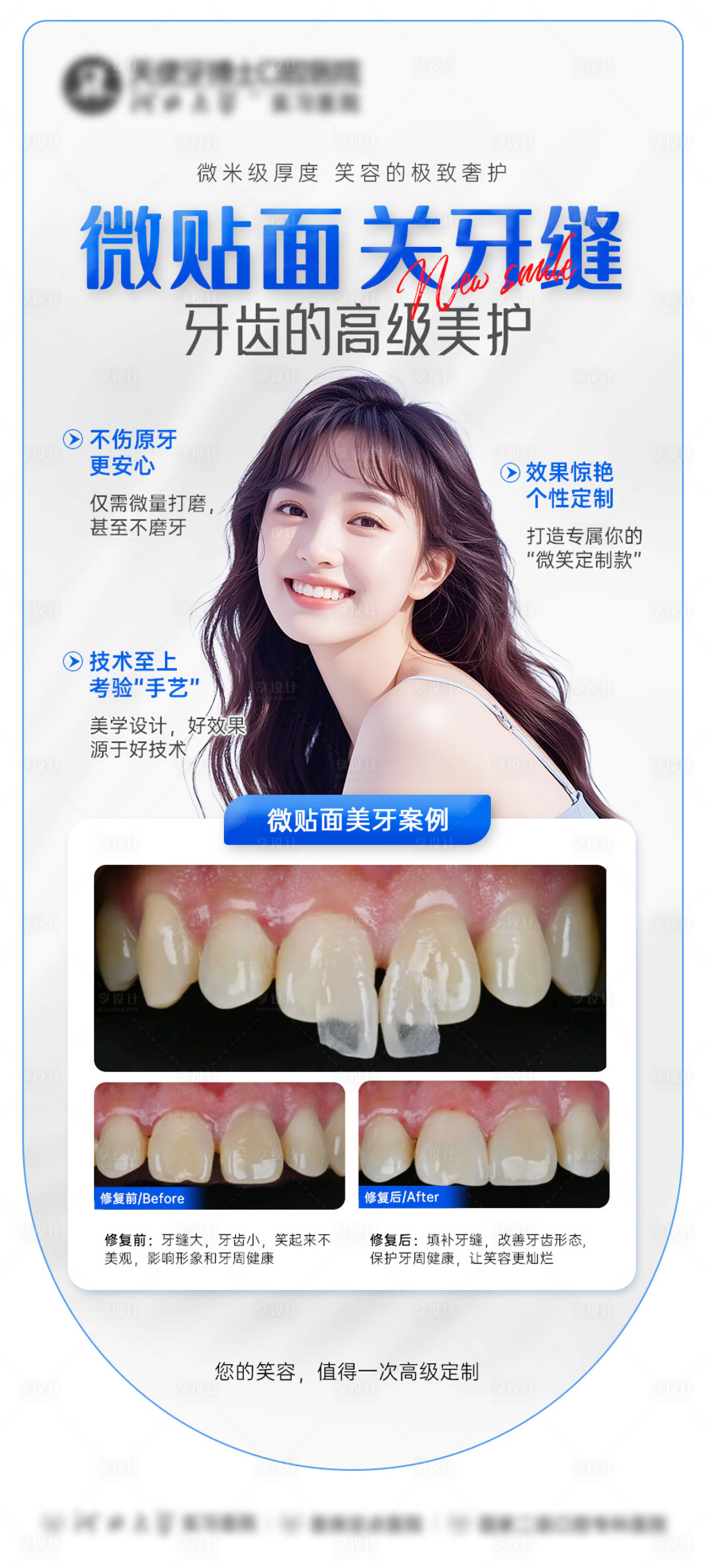 源文件下载【享设计】搜索编号：91980034155356474【牙贴面案例海报】