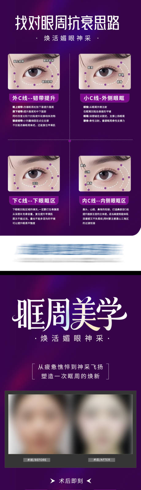 源文件下载【享设计】搜索编号：12340033991273438【医美眼眶眼周抗衰美学案例科普创意系列】