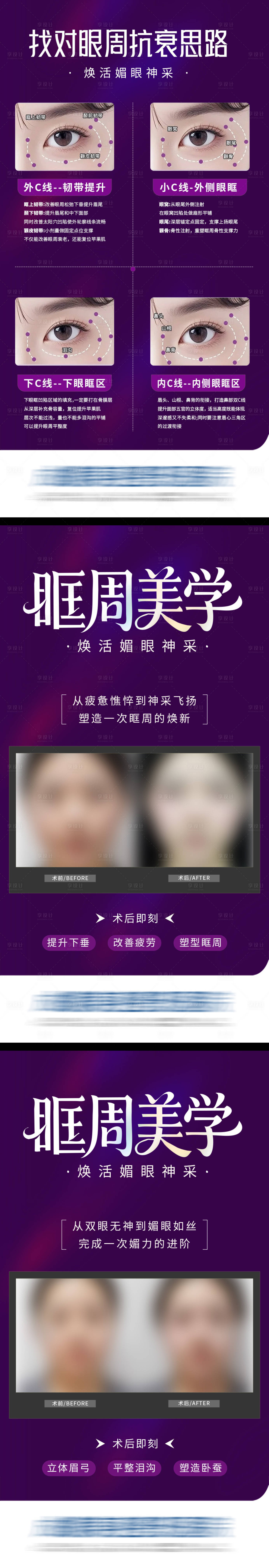源文件下载【享设计】搜索编号：12340033991273438【医美眼眶眼周抗衰美学案例科普创意系列】