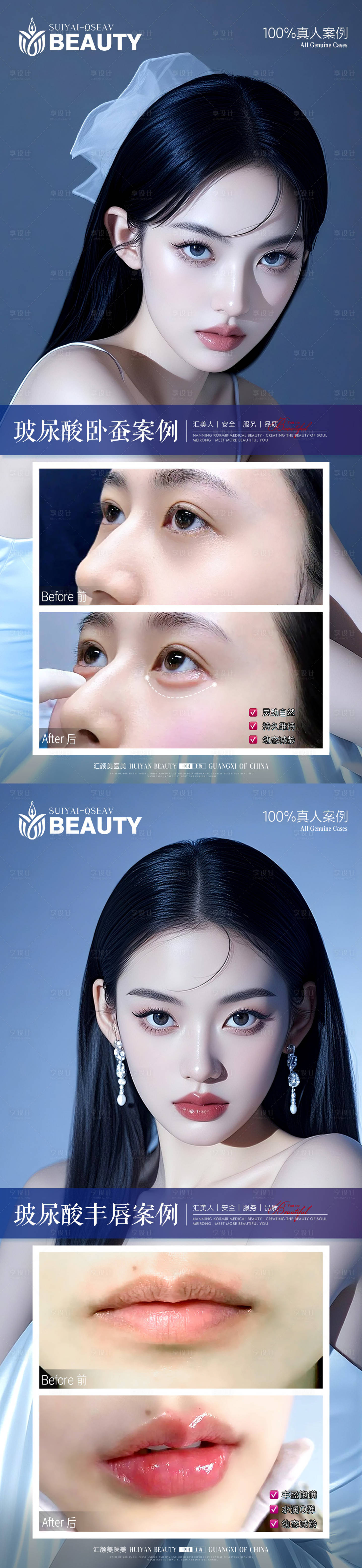 源文件下载【享设计】搜索编号：68560033962919832【医美案例】