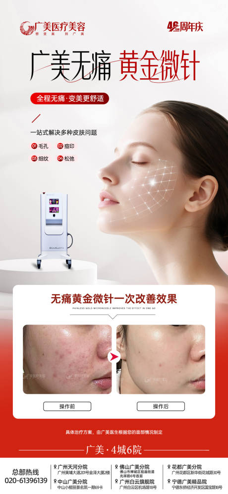 源文件下载【享设计】搜索编号：22230033999615032【黄金微针海报】