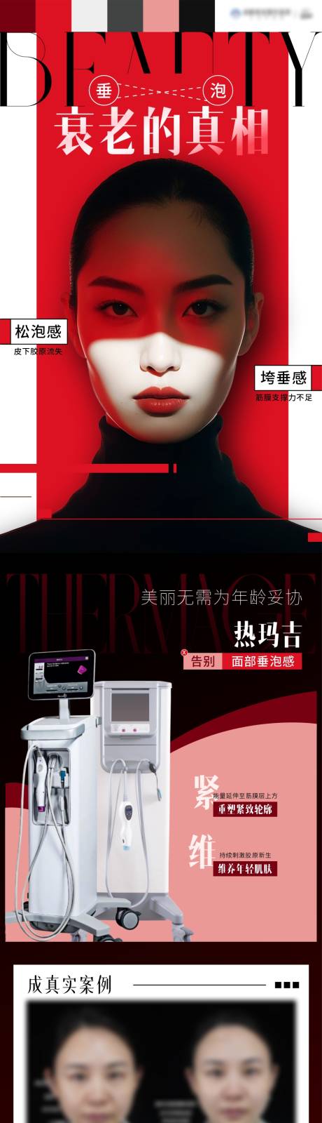 源文件下载【享设计】搜索编号：38290033871752643【医美热玛吉抗衰高端仪器海报】