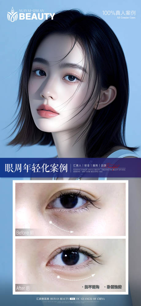 源文件下载【享设计】搜索编号：30020034036665237【医美案例】