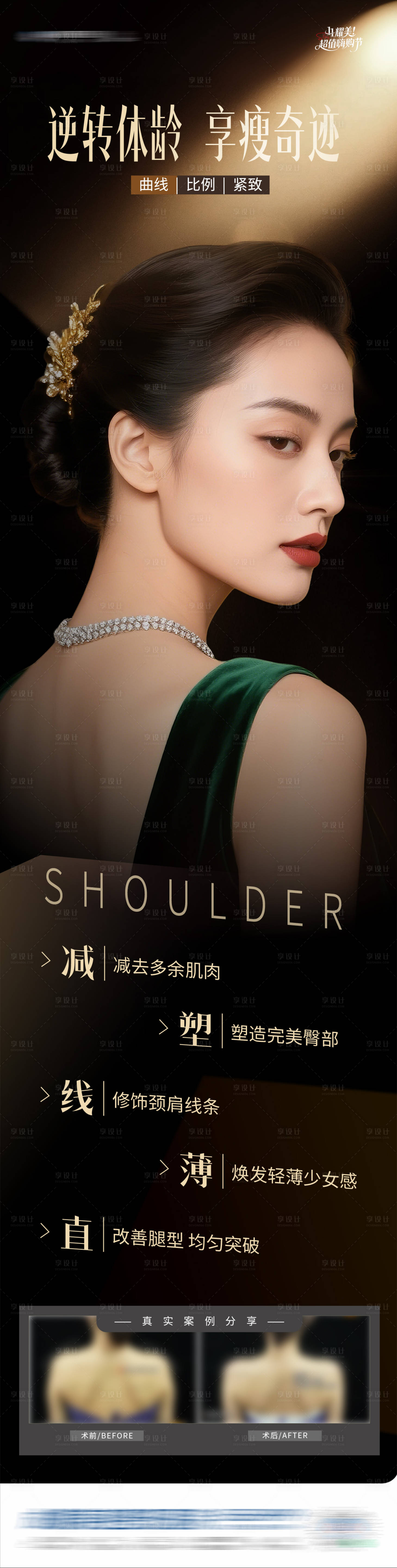 源文件下载【享设计】搜索编号：18550034160292313【医美肉毒素形体塑型案例创意海报】