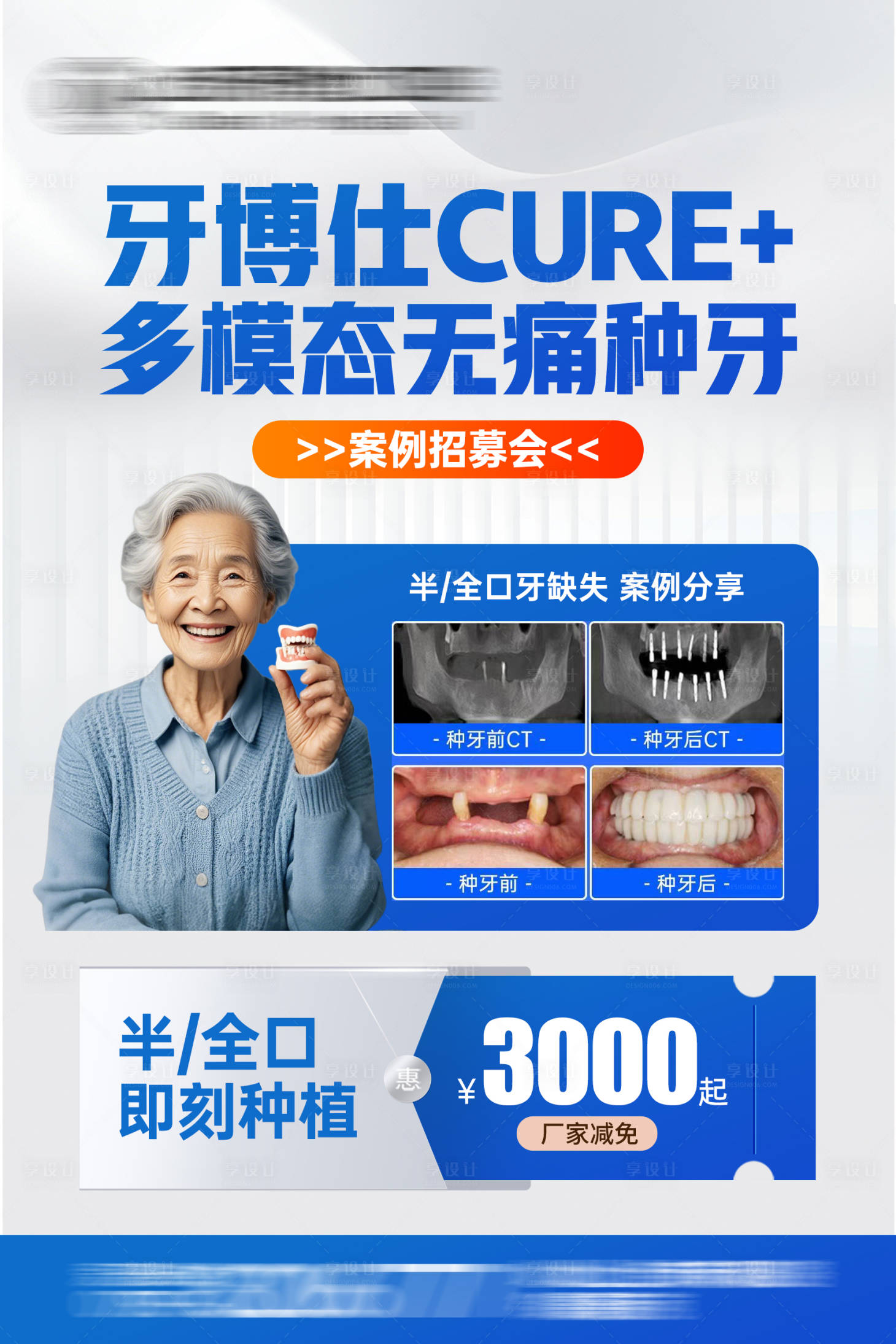 源文件下载【享设计】搜索编号：47590033969254873【无痛种植牙案例海报】