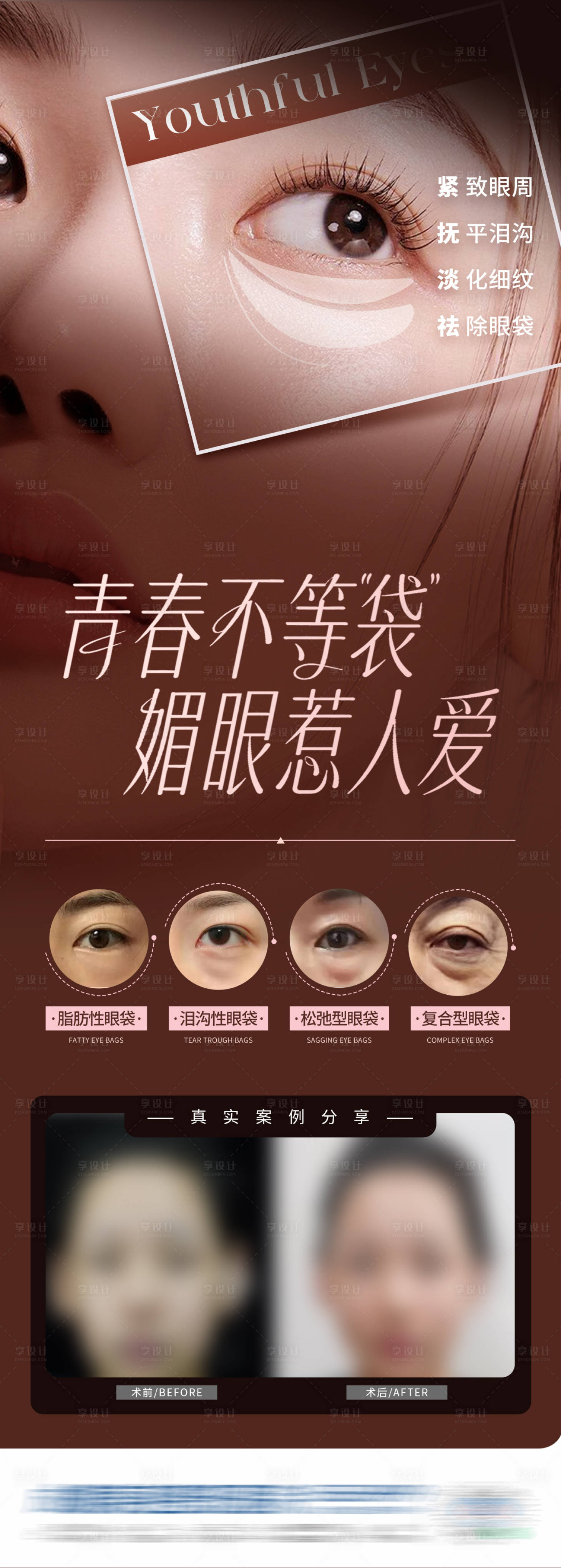 源文件下载【享设计】搜索编号：63510034047177904【医美三联祛眼袋眼部创意海报】