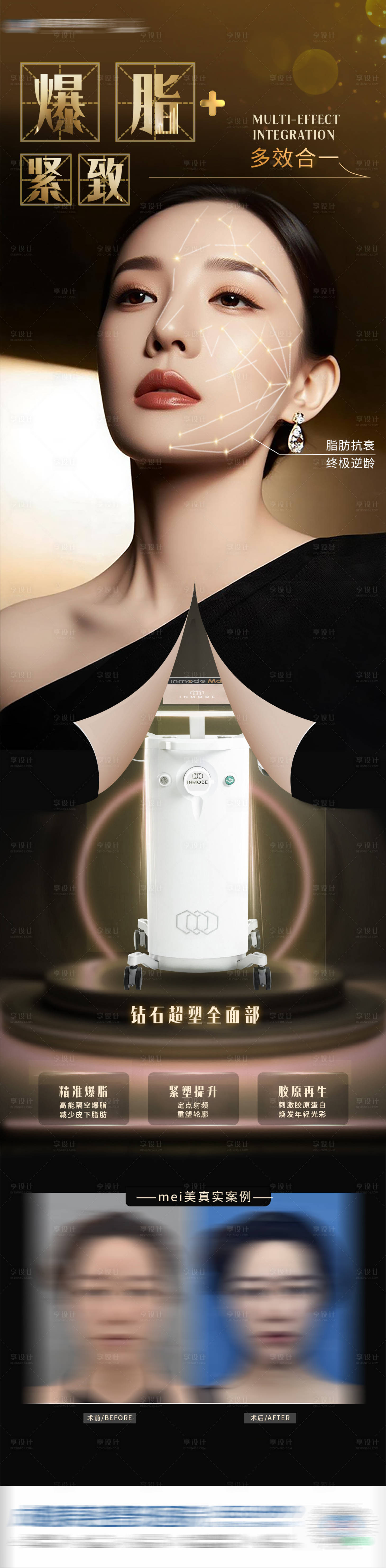 源文件下载【享设计】搜索编号：98930034100772119【钻石精雕瘦脸减脂海报】