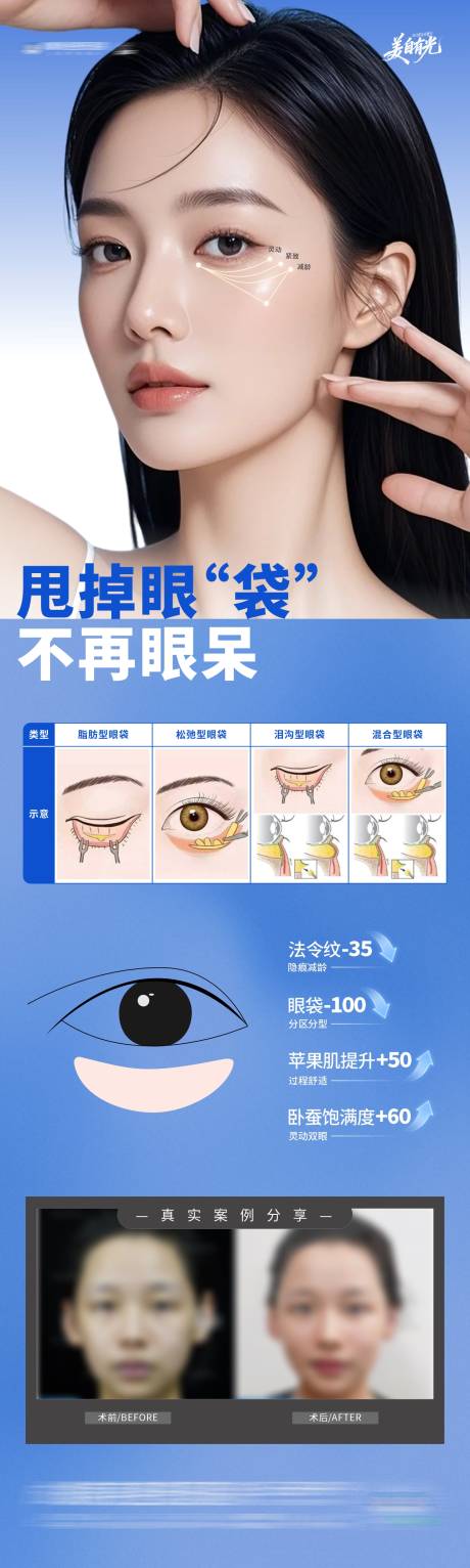 源文件下载【享设计】搜索编号：52530034262012600【医美三联祛眼袋眼部案例创意长图海报】