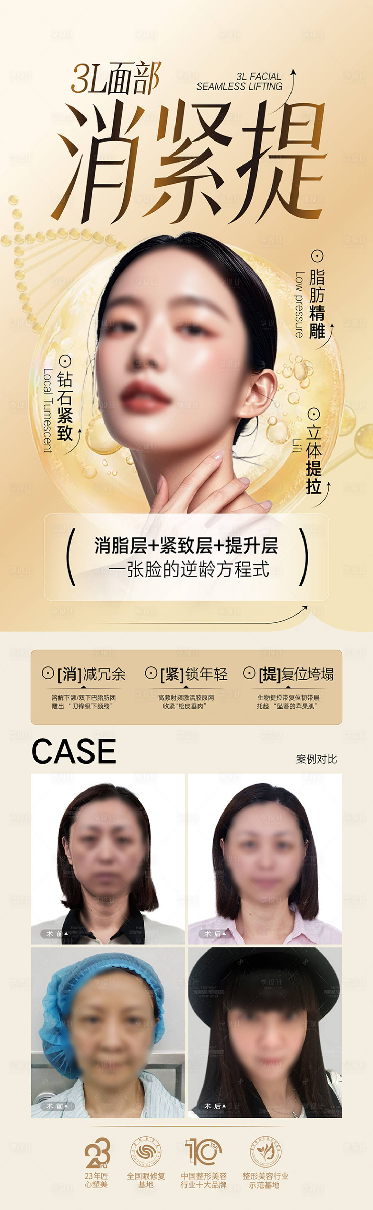 源文件下载【享设计】搜索编号：19500033846118541【整形美容脂肪女神丰胸长图海报  】