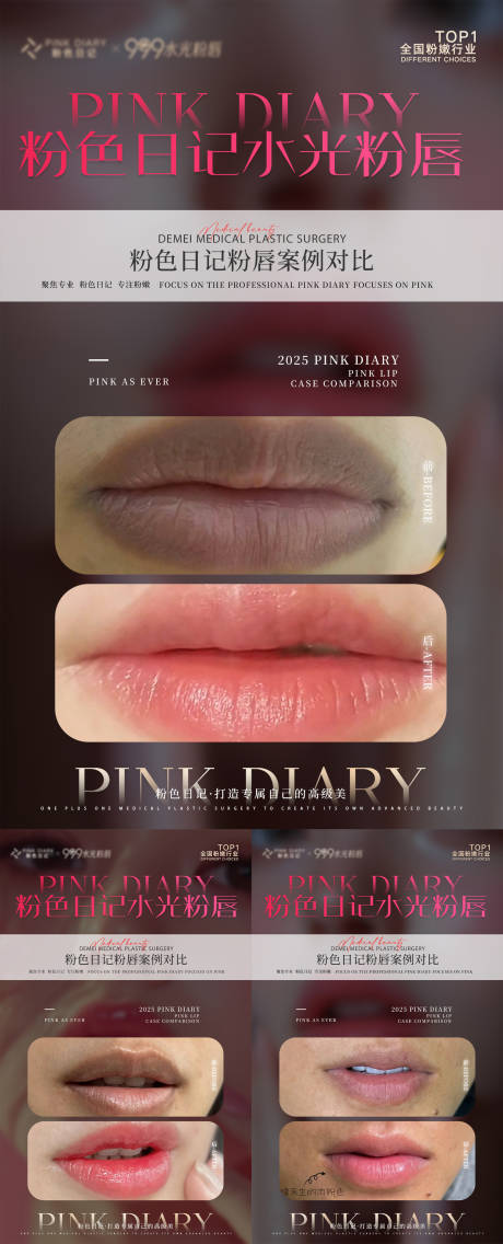 源文件下载【享设计】搜索编号：57150034179371670【医美对比案例海报】