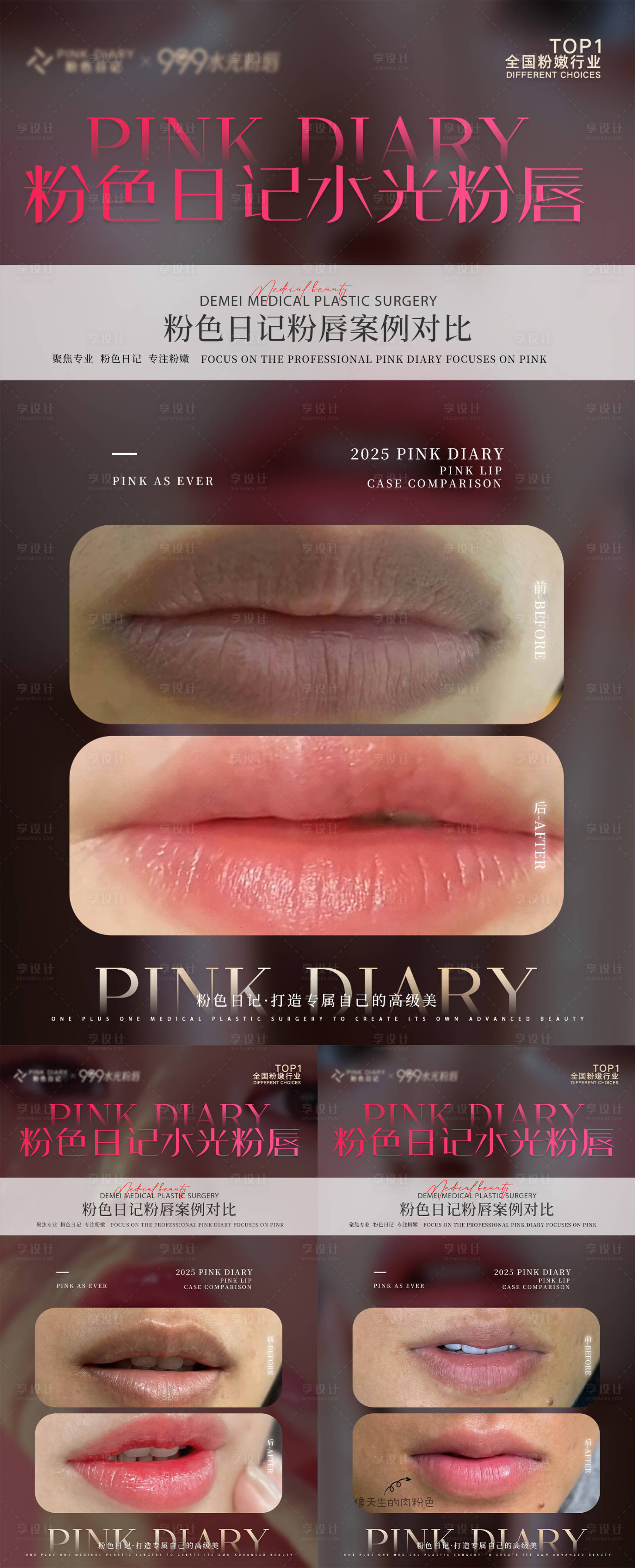 源文件下载【享设计】搜索编号：57150034179371670【医美对比案例海报】
