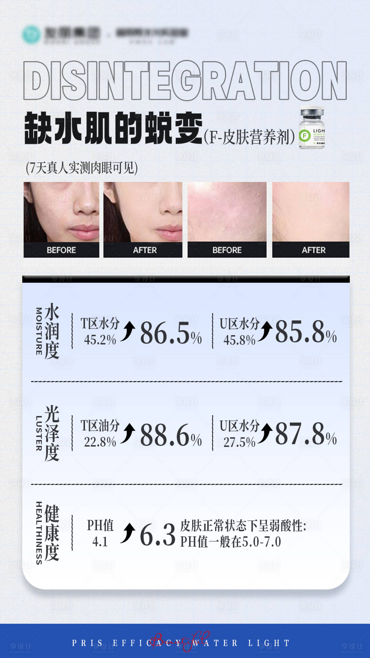 源文件下载【享设计】搜索编号：87380033878783829【缺水肌的蜕变】