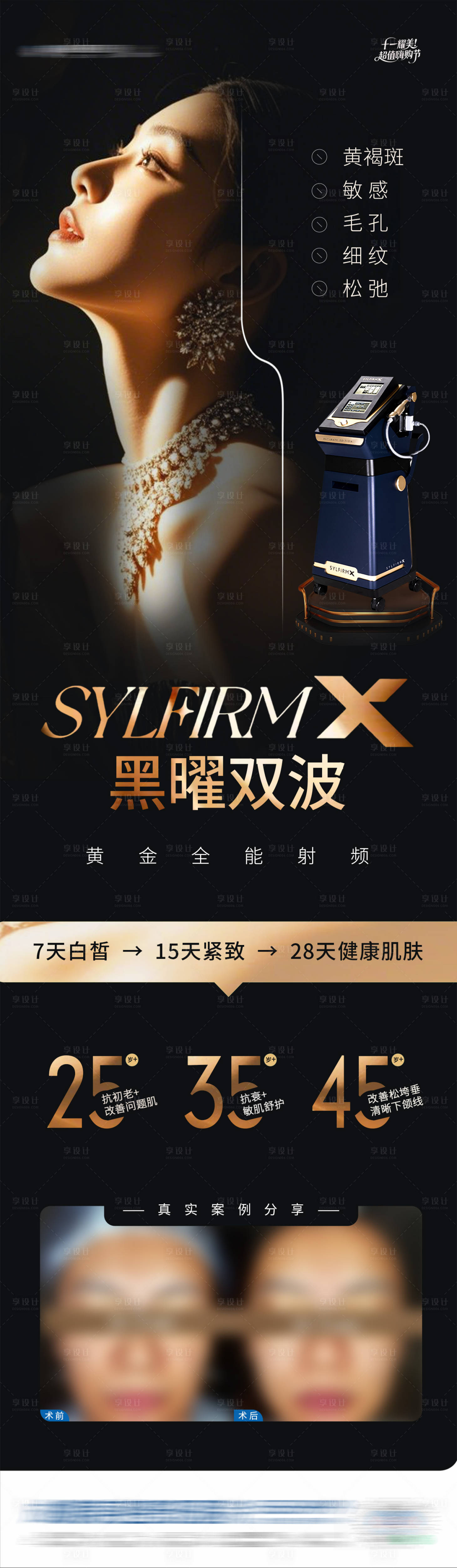 源文件下载【享设计】搜索编号：69780033972722958【医美黑曜双波黄金微针仪器案例创意海报】