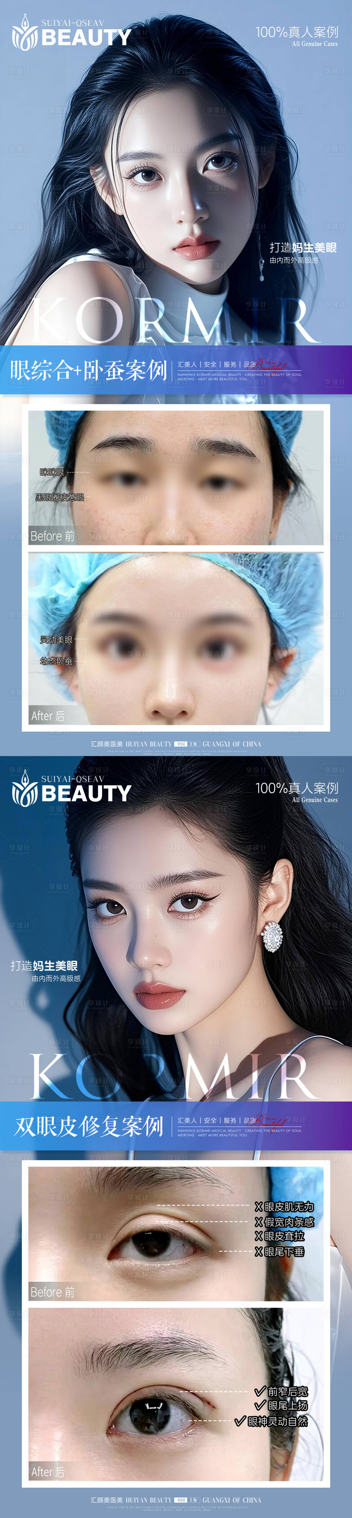 源文件下载【享设计】搜索编号：23460034213774287【医美案例系列海报】