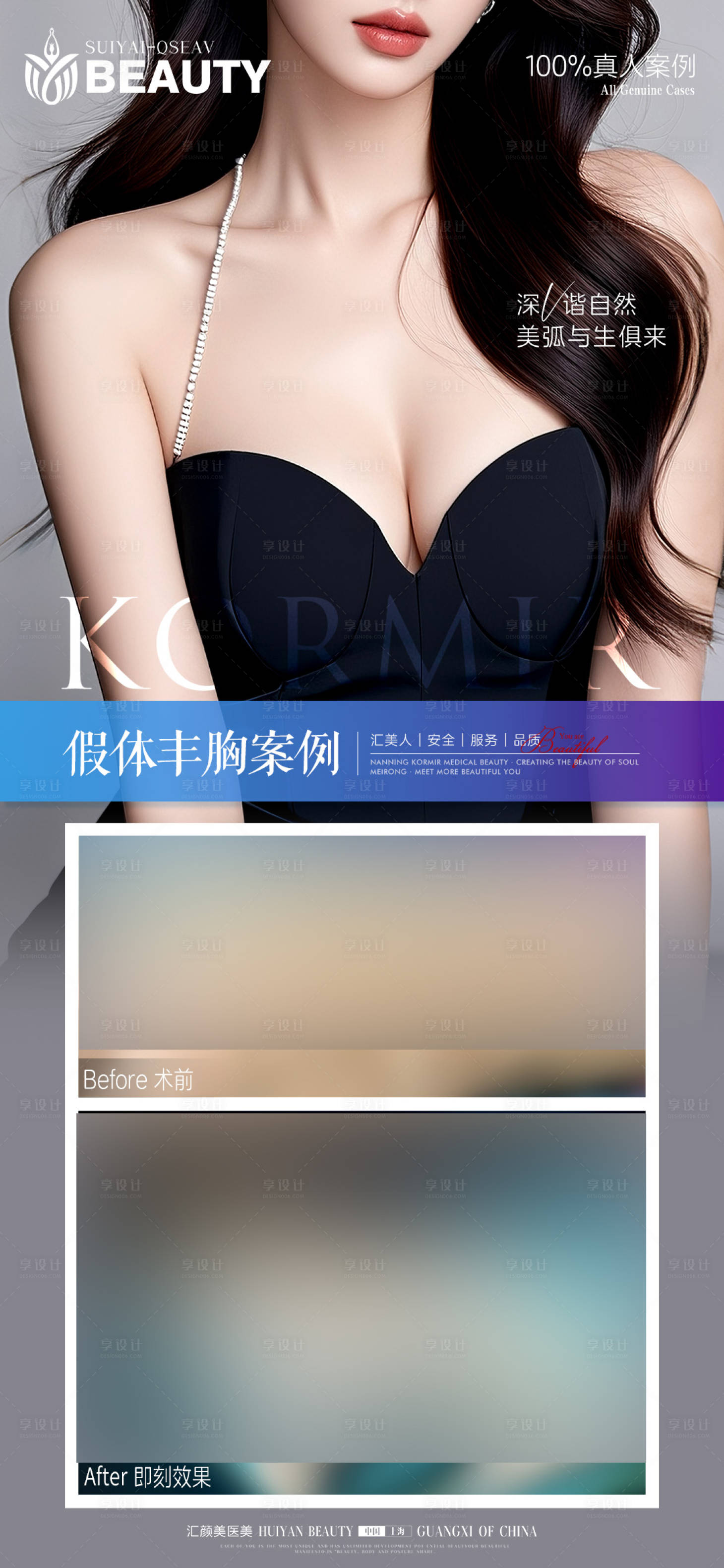 源文件下载【享设计】搜索编号：40140034168995027【丰胸案例】