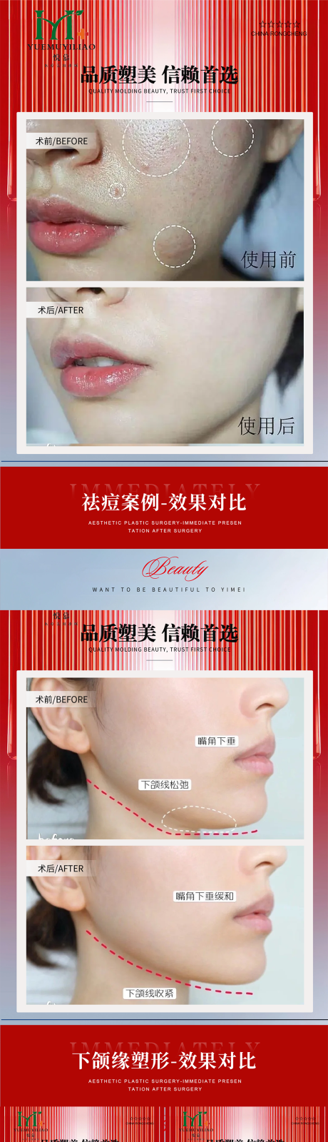 源文件下载【享设计】搜索编号：85740033964308004【医美案例】