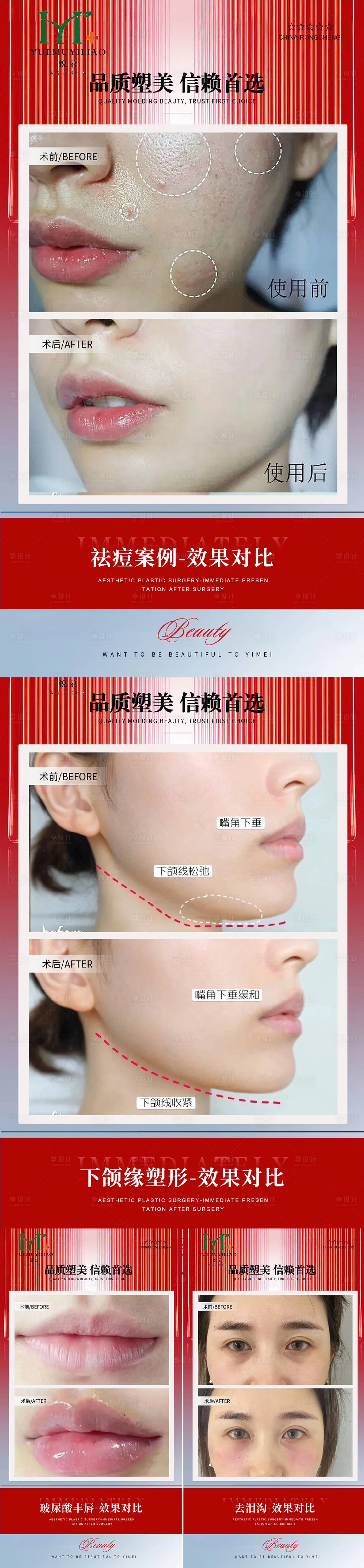 源文件下载【享设计】搜索编号：85740033964308004【医美案例】