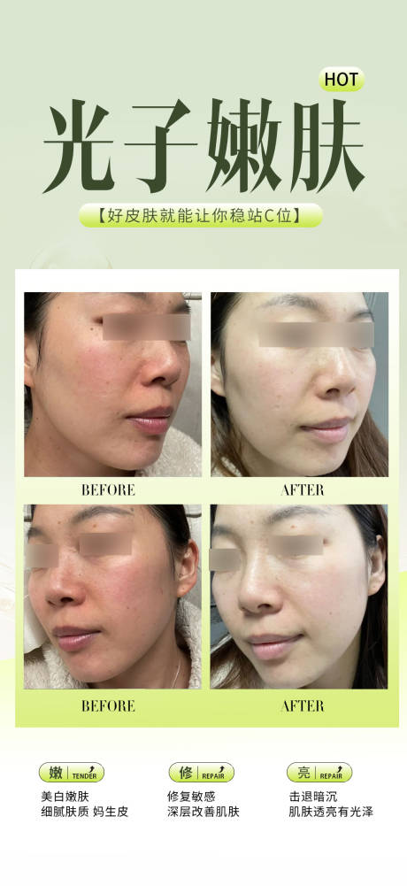 源文件下載【享設計】搜索編號：77190034071394015【光子嫩膚案例】