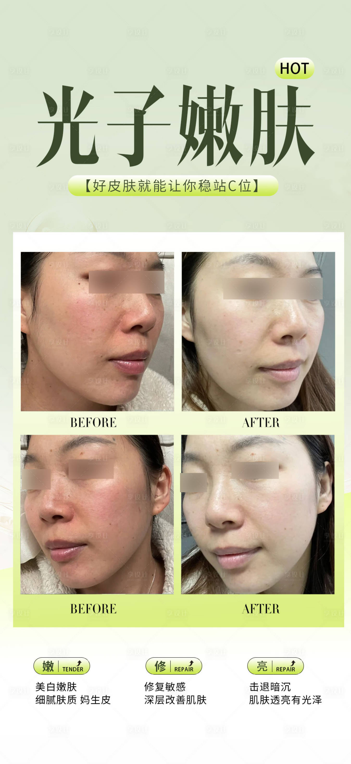 源文件下載【享設計】搜索編號：77190034071394015【光子嫩膚案例】