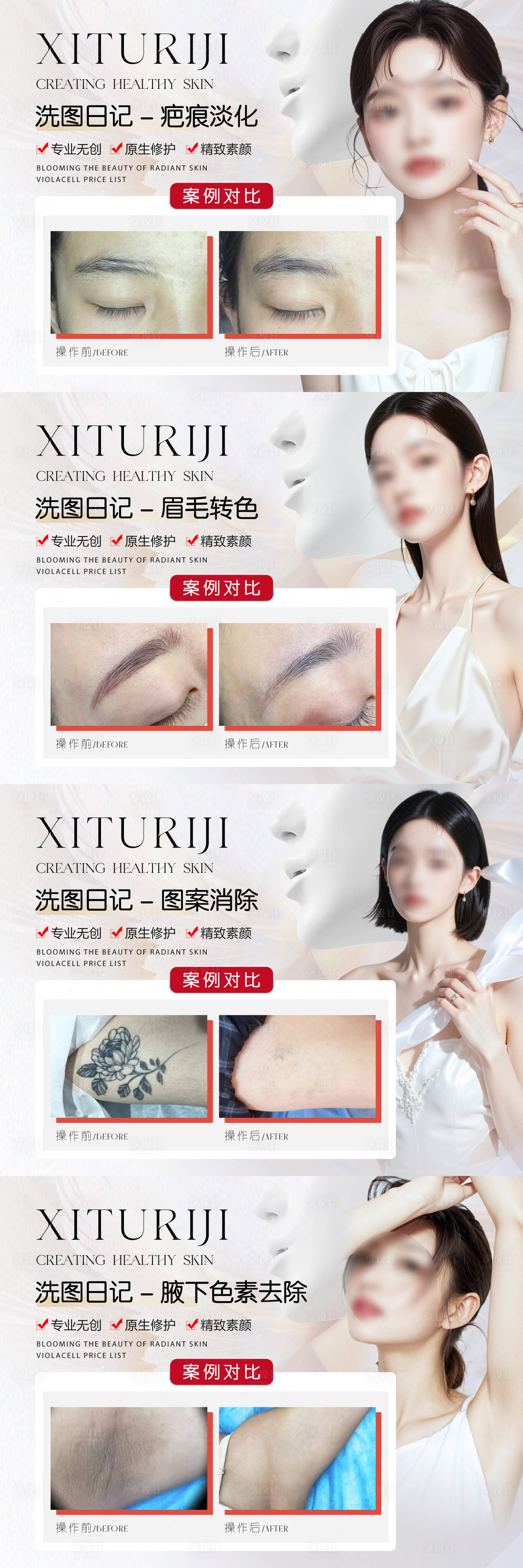 源文件下载【享设计】搜索编号：61060033950815086【医美洗眉疤痕纹身祛除案例海报】