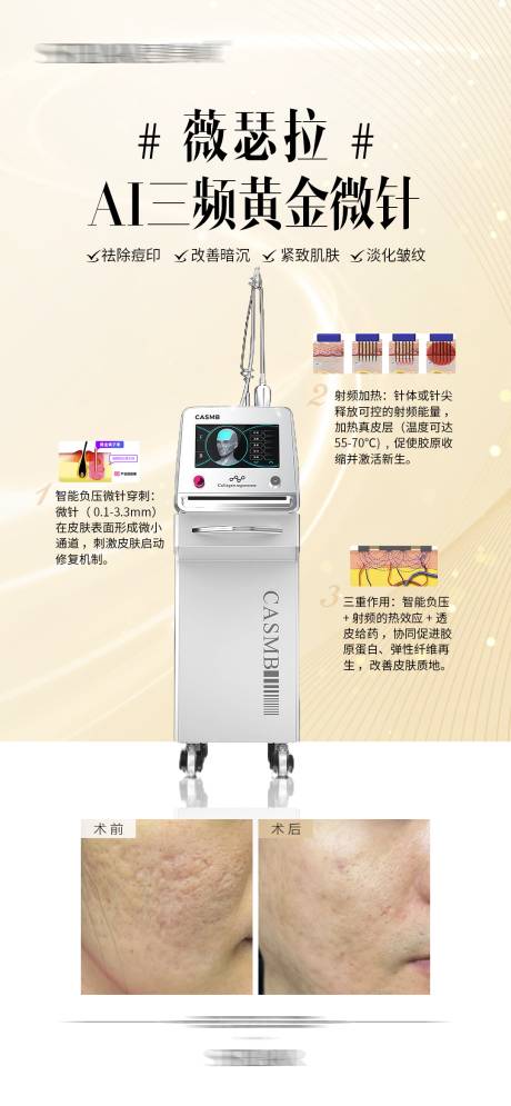 源文件下载【享设计】搜索编号：93420034079251257【薇瑟拉AI三频黄金微针案例宣传海报】