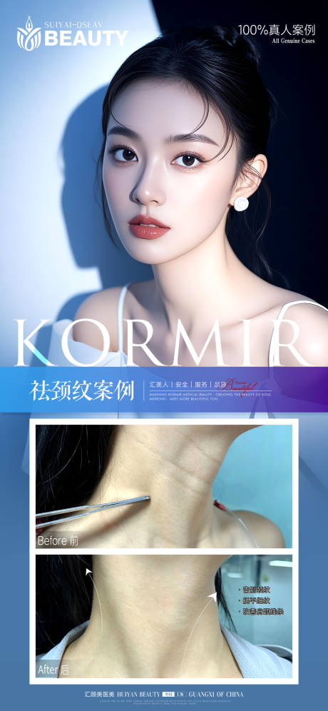 源文件下载【享设计】搜索编号：11180034107039581【医美祛颈纹案例海报】